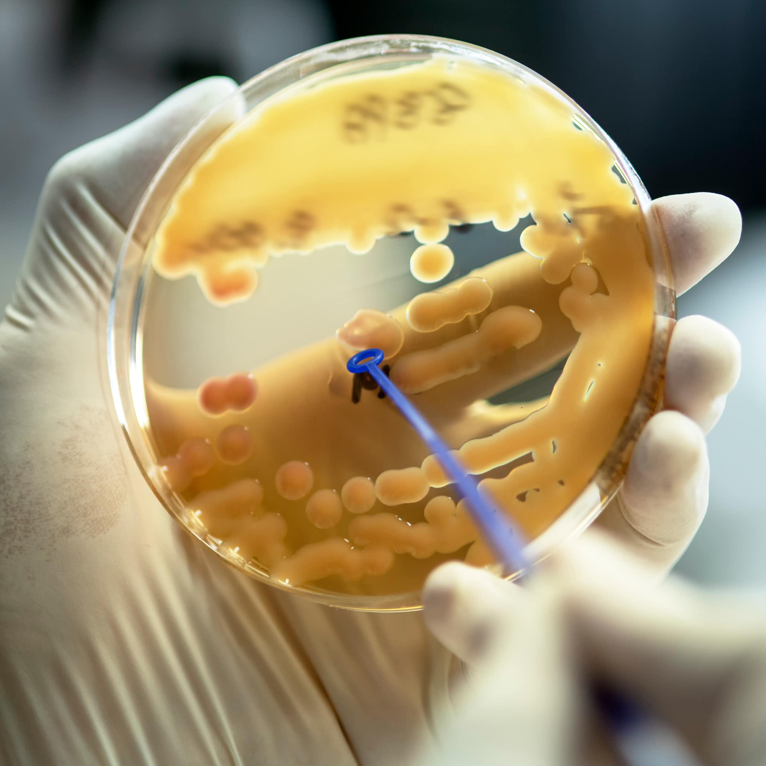 A scientist holds an agar plate where colonoies of Klebsiella pneumoniae have been grown.